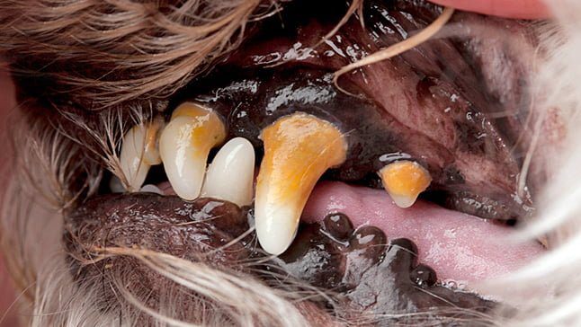 dientes con sarro